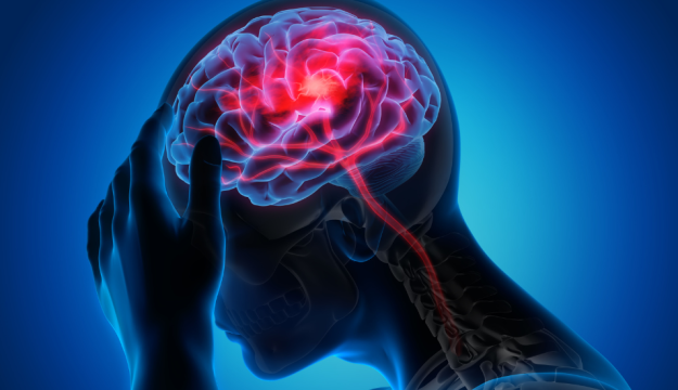 Act FAST when identifying a stroke